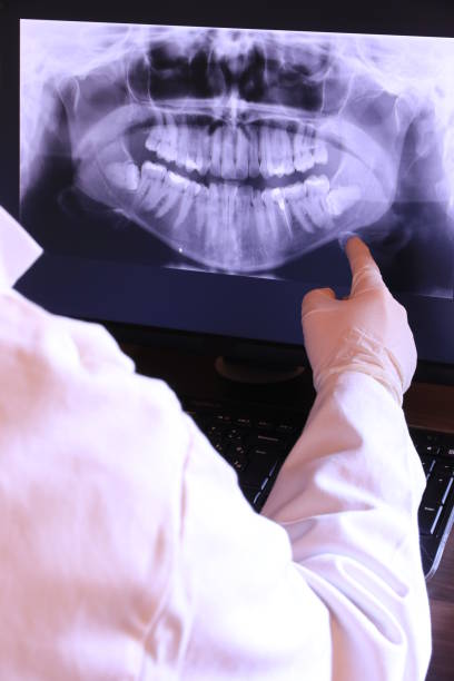 Best Knocked-Out Tooth (Avulsed Tooth) Treatment in Pike Road, AL